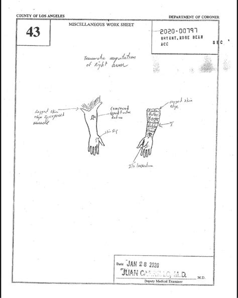 gigi kobe autopsy|Kobe Crash Autopsy Reports : r/CrimeScene